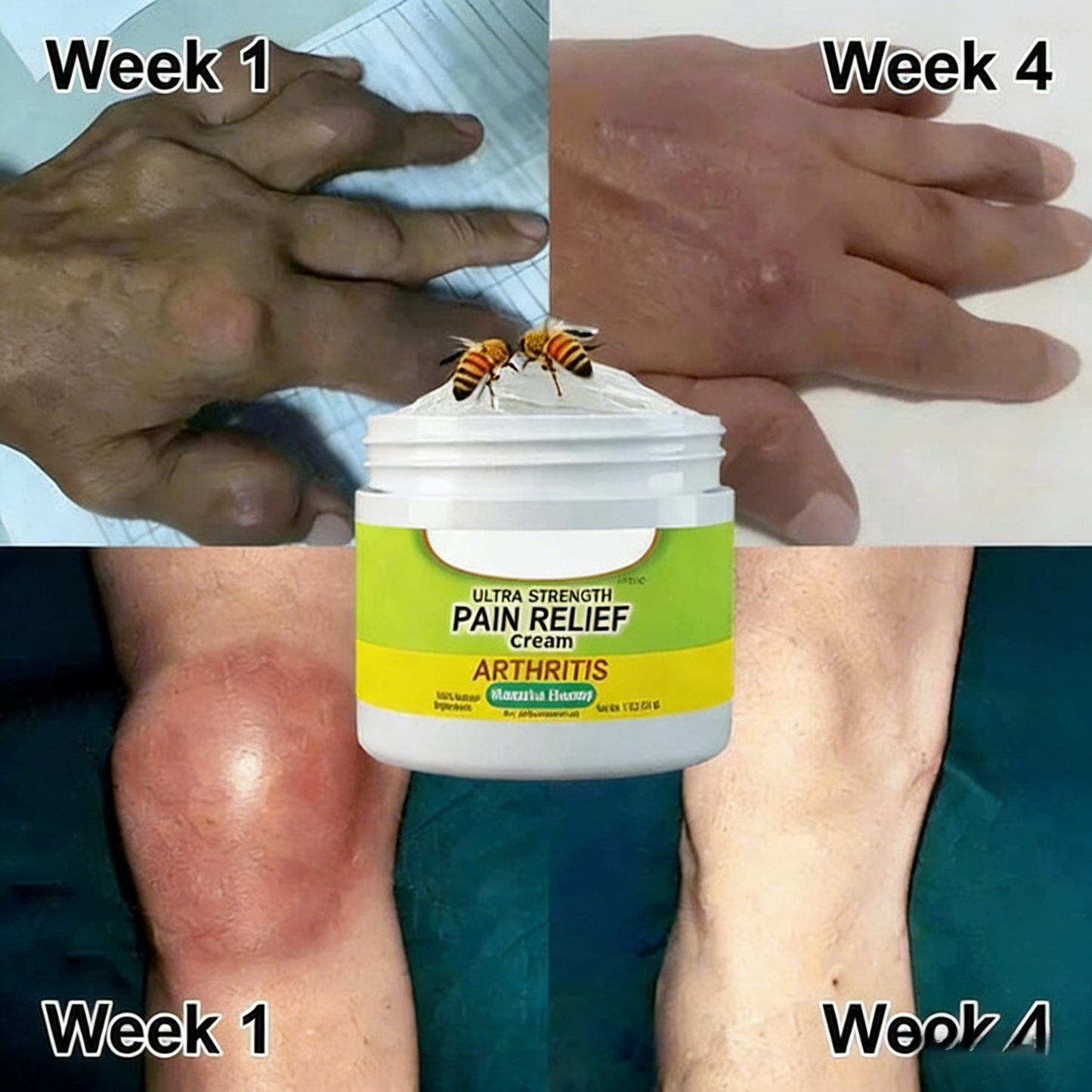 🐝New Zealand Bee venom Joint and Bone Therapy Advanced Cream⏳Limited time discount of 80%⏳
