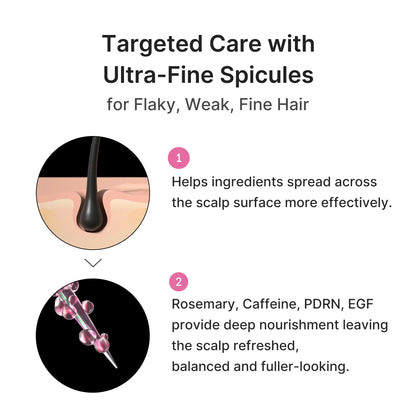 Rosemary PDRN Spicule Scalp Serum| Dry & Oily, Flaky-looking Scalp