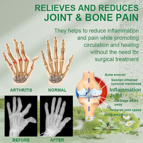 🐝New Zealand Bee venom Joint and Bone Therapy Advanced Cream⏳Limited time discount of 80%⏳