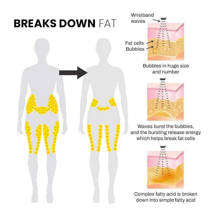 (🔥LAST DAY 70% OFF) KLENIMOREBody Shape Wristband Pro（LAST DAY Free shipping)）