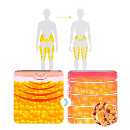 (🔥LAST DAY 70% OFF) KLENIMOREBody Shape Wristband Pro（LAST DAY Free shipping)）